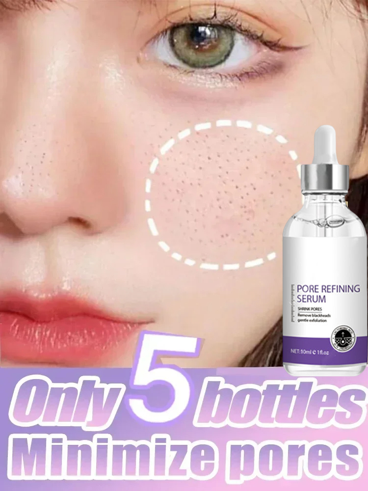3차 피부 질감 |   모공 개선, 피부 재생 및 브라 - The Ordinary Serum Hyaluronic Acid 리뷰 및 가격
